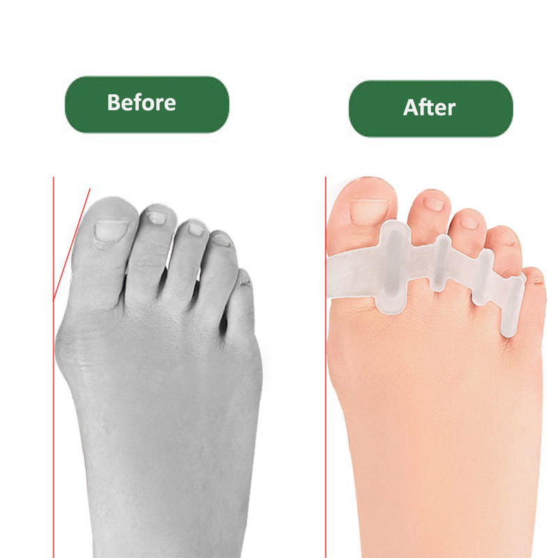 Pexmen 2/4Pcs Gel Toe Separato - Power Tools Hammer review and price